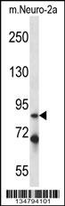 Mouse Irak1 Antibody
