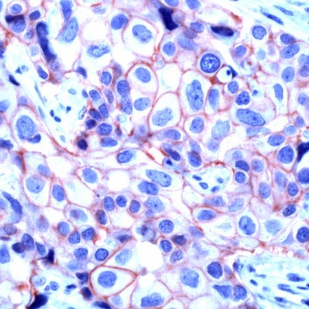 ERBB2 Antibody