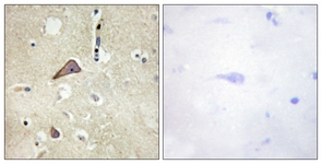 NMDAR1 (Phospho-Ser896) antibody
