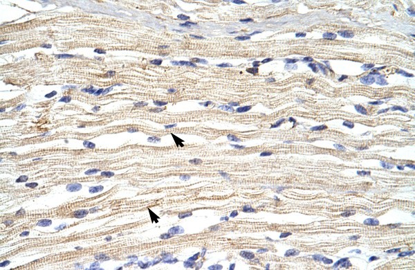 FBXL11 antibody - N-terminal region