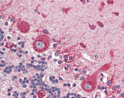 Calreticulin Antibody
