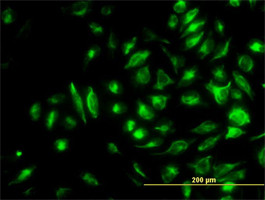 NME2 Antibody (monoclonal) (M06)