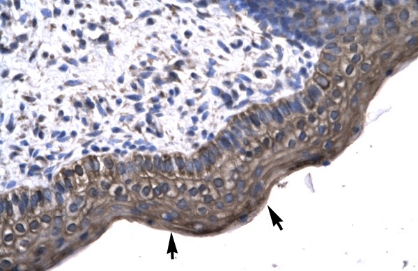 KIN antibody