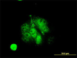 MEF2A Antibody (monoclonal) (M08)