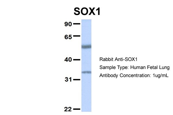 SOX1 antibody - middle region
