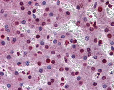 STAT3 Antibody