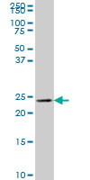 MLC1SA Antibody (monoclonal) (M01)