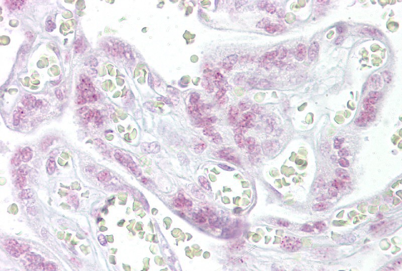 CHEK2 antibody