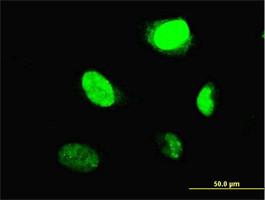MYBL2 Antibody (monoclonal) (M02)