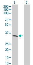 MPPED2 Antibody (monoclonal) (M01A)