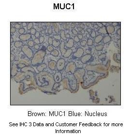 MUC1 antibody - C-terminal region