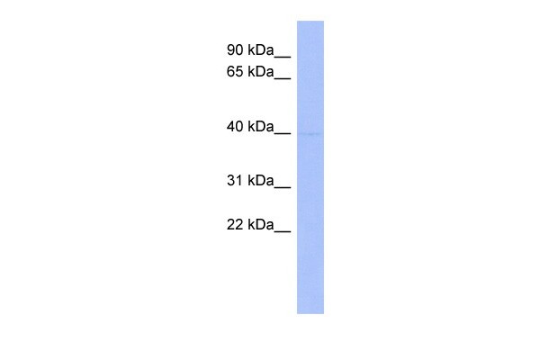 MEIS1  antibody - middle region