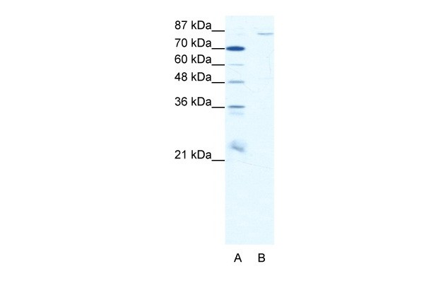 MEFV antibody - N-terminal region
