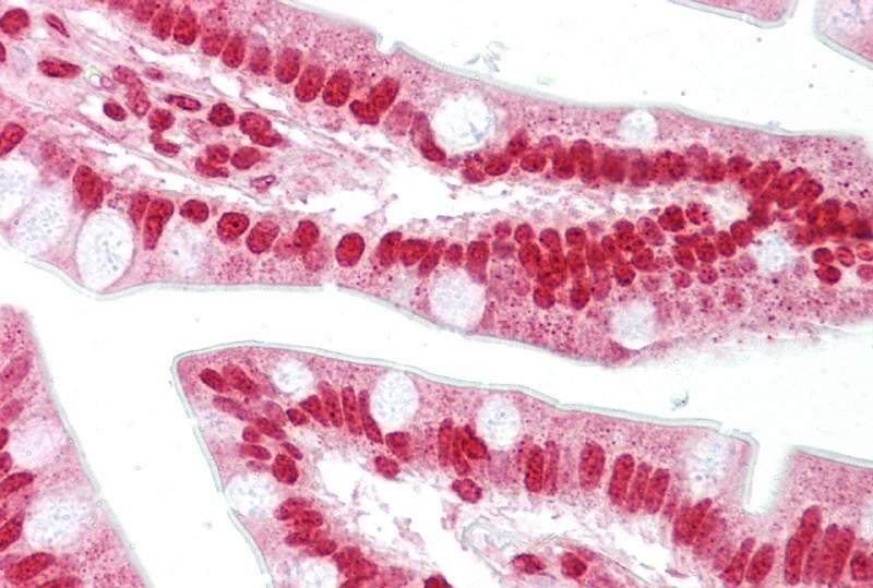OAS1 antibody - C-terminal region