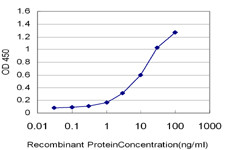 MSMB Antibody (monoclonal) (M08)