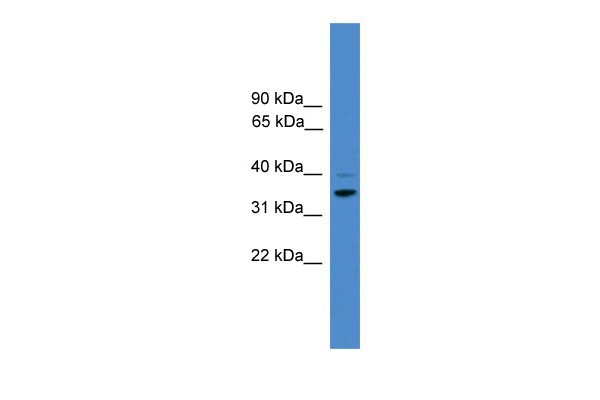 CCNH antibody