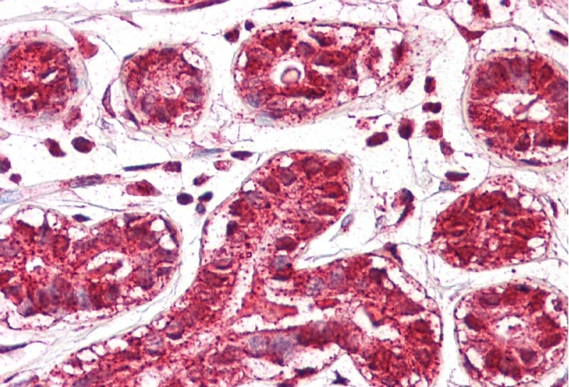PTDSR antibody - middle region