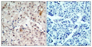 HER2 antibody
