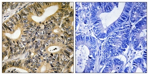 4E-BP1 (Phospho-Thr70) antibody
