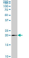 MRPS25 Antibody (monoclonal) (M01)
