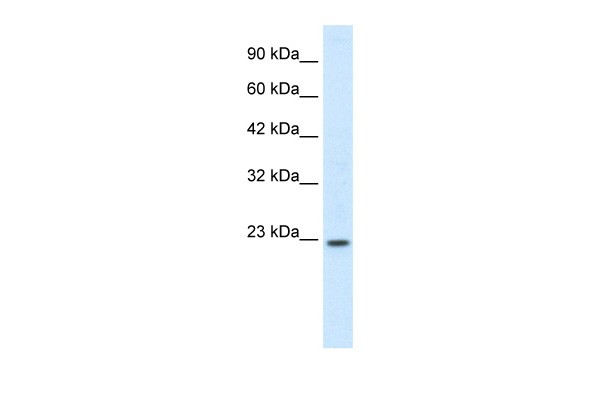 HOXB6 antibody