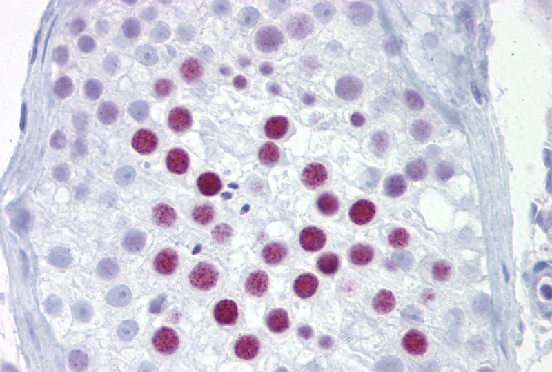 PHOX2A antibody - N-terminal region