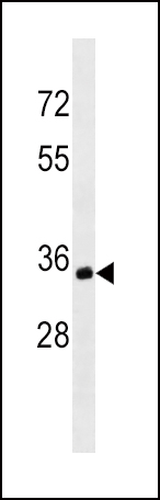 MS4A1/CD20 Antibody (C-term)