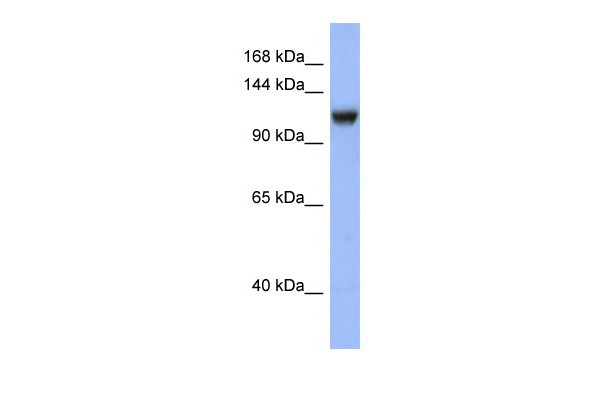 NR3C2 antibody
