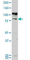 NEK5 Antibody (monoclonal) (M02)
