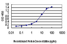 MYO7A Antibody (monoclonal) (M01)