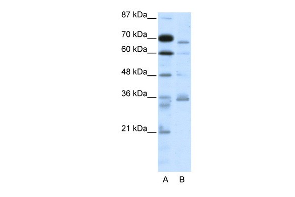 PCSK6 antibody - N-terminal region