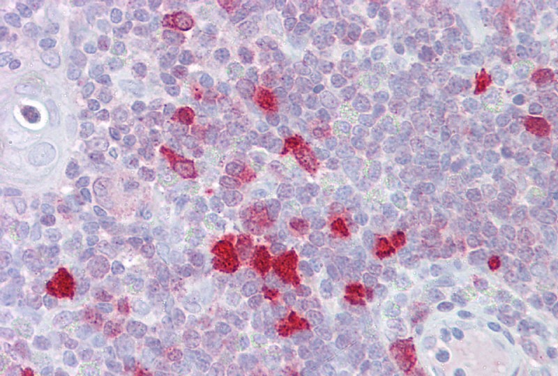 DLX5 antibody - N-terminal region