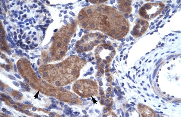 ZNFN1A2 antibody - C-terminal region