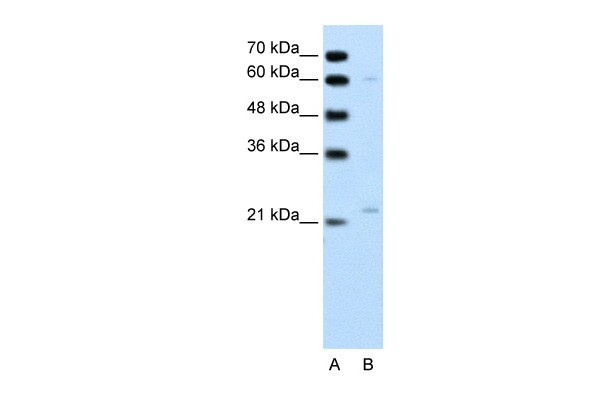 RGS4 antibody