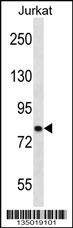 CACNB2 Antibody