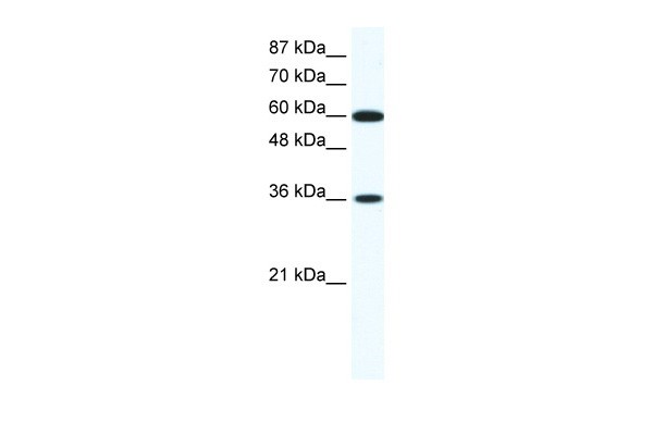 FOXF1 antibody - N-terminal region