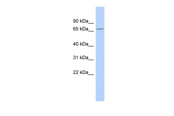 ZNF404 antibody - middle region