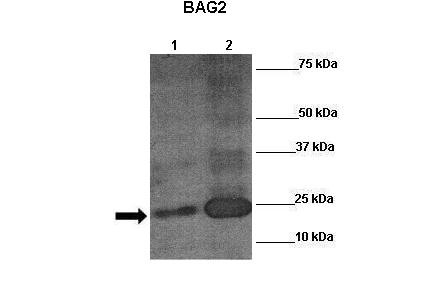 Arnt antibody