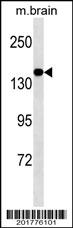 MED14 Antibody (Ascites)