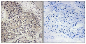 p70 S6 Kinase (Phospho-Ser424) antibody