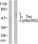 Tau (Phospho-Ser262) antibody