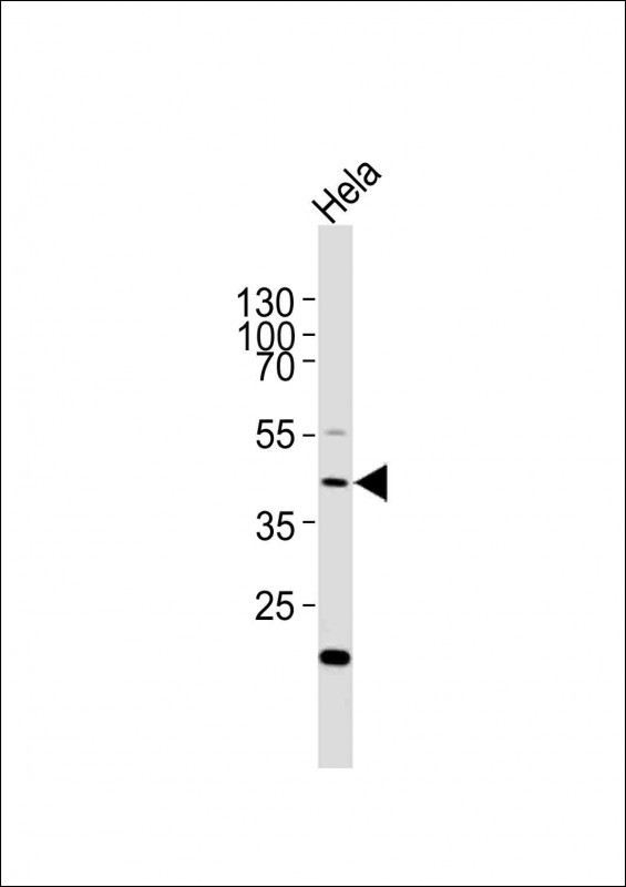 E2F1 Antibody