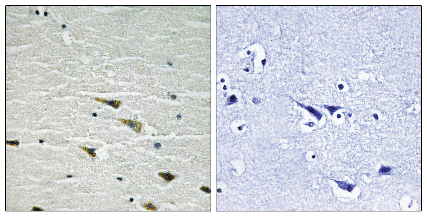 Trk A (phospho Tyr757) Antibody