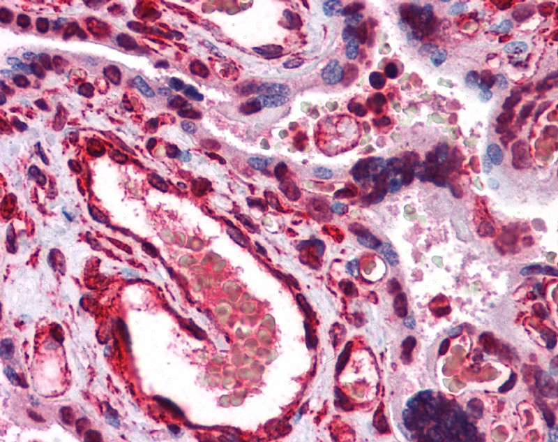 LIPG antibody - middle region