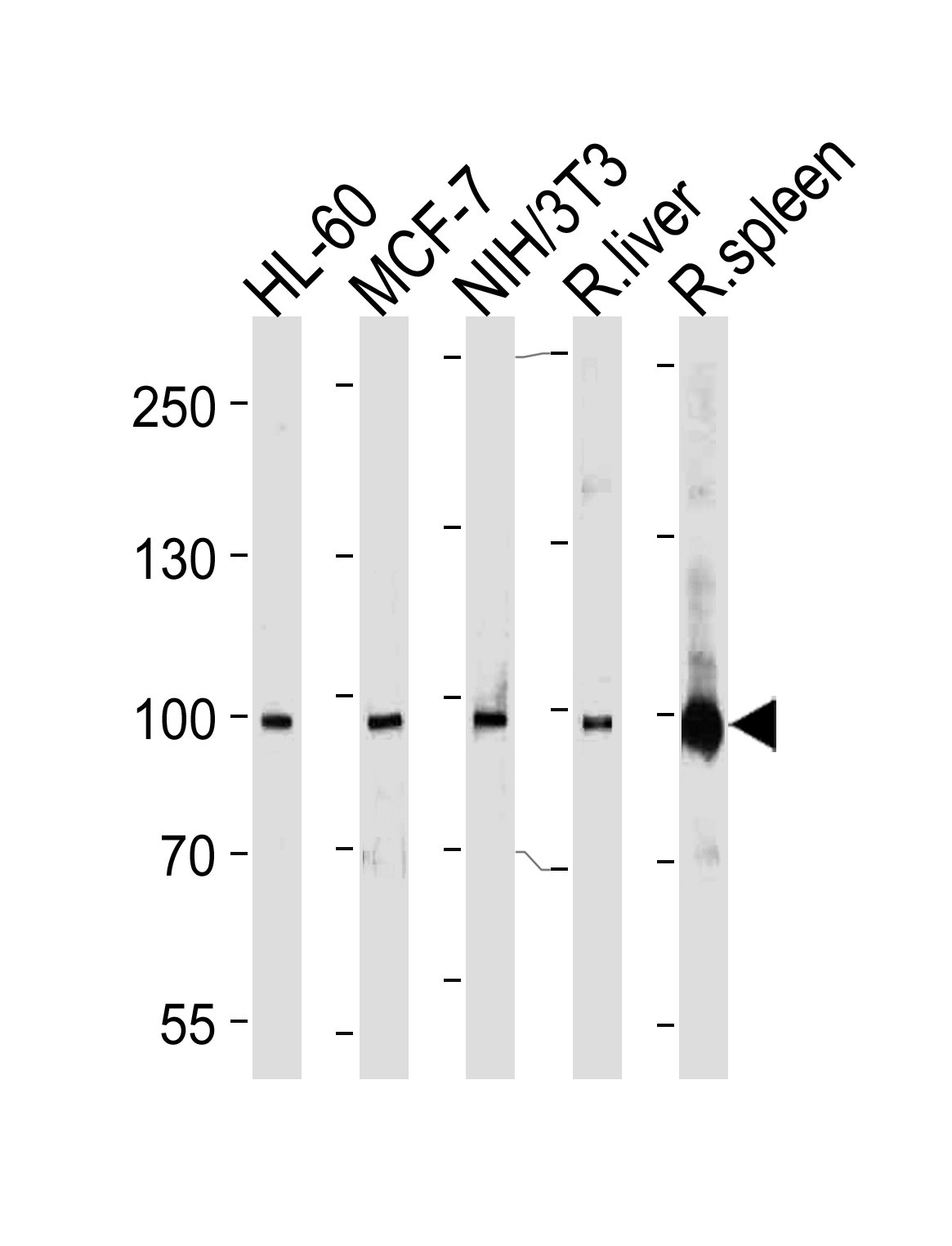 STAT5b Antibody