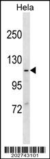 MVP Antibody (N-term) (Ascites)