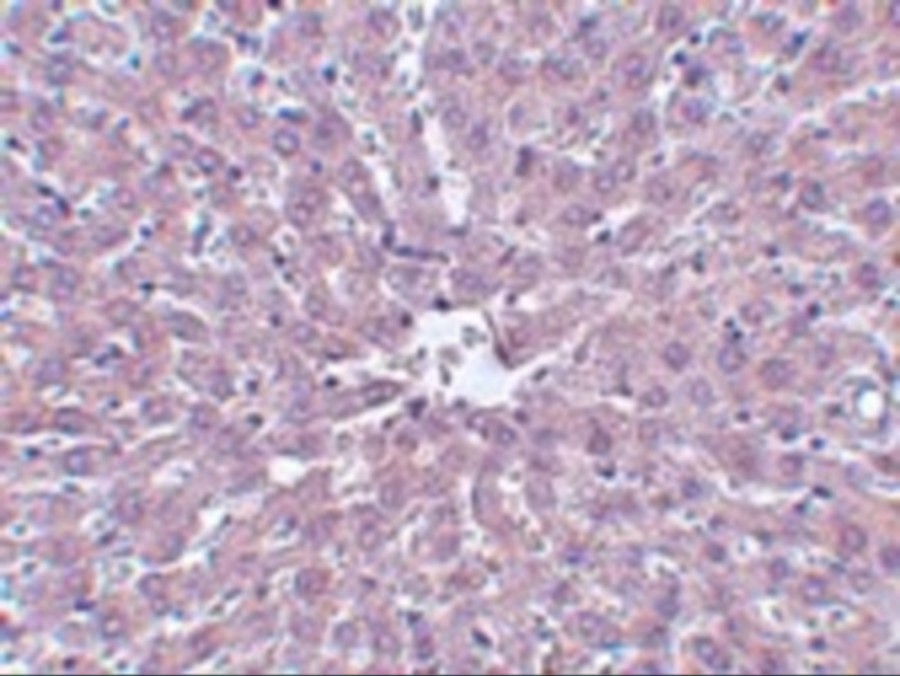IRAK Antibody