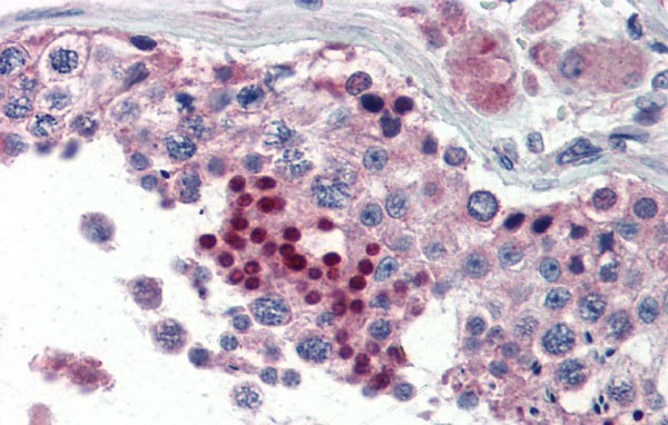 NR0B1 antibody - middle region