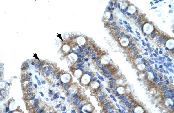 EVI1 antibody
