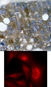 HSP27 (phospho Ser15) Antibody